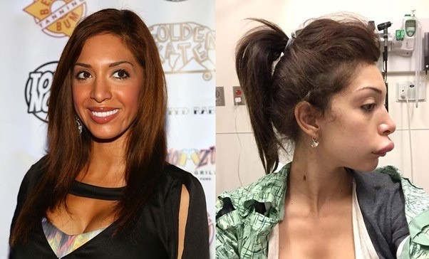 Farrah-Abraham