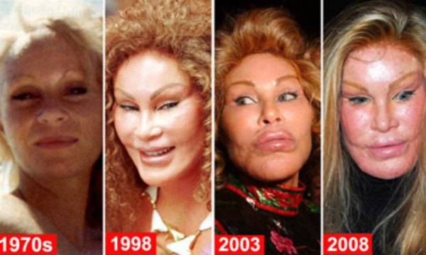 Jocelyn Wildenstein