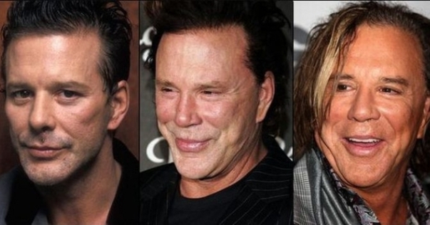 Mickey Rourke